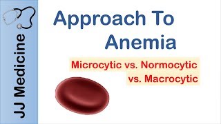 Anemia  Microcytic vs Normocytic vs Macrocytic [upl. by Annoiek]