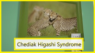 ChediakHigashi Syndrome Mnemonic for the USMLE [upl. by Aitetel]