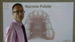 A Narrow Palate By Dr Mike Mew [upl. by Gregor]