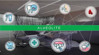 Alvéolite dentaire  étiologie  symptômes et traitement dentist [upl. by Tezzil]