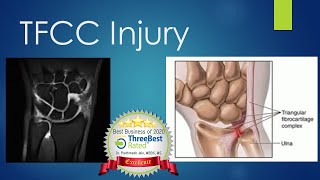 TFCC Injury How Problem Treatment Diagnosis [upl. by Enilecram335]