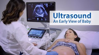 Breast Ultrasound  normal anatomy [upl. by Gnot]