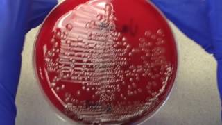 Plate Reading  Urine I [upl. by Godfry]