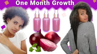 Onion Juice For Hair Growth 😱BEFORE AND AFTER RESULTS [upl. by Edmondo]