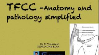 TFCC Triangular Fibrocartilage Complex [upl. by Einegue509]