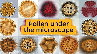 Pollen under the microscope [upl. by Grimaldi]