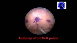 Anatomy of the Soft Palate [upl. by Avron]