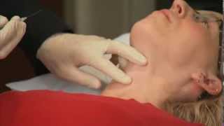 How to Place a Laryngeal Mask Airway Part 1 [upl. by Arfihs]