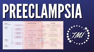 Preeclampsia Explicada Claramente [upl. by Christel]