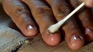 How to Cure Nail Fungus [upl. by Mayce]