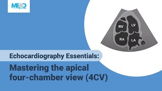 Echocardiography Essentials Mastering the apical fourchamber view 4CV [upl. by Broddy]