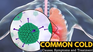 Common Cold Causes Signs and Symptoms Diagnosis and Treatment [upl. by Morganica]