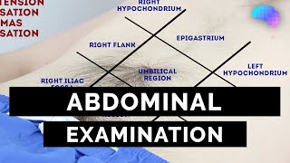 Abdominal Examination  OSCE Guide Latest  UKMLA  CPSA  PLAB 2 [upl. by Cardon]