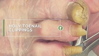 HOLY TOENAIL CLIPPINGS [upl. by Oidgime]