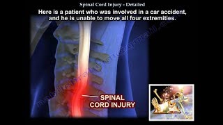 Spinal Cord Injury Detailed  Everything You Need To Know  Dr Nabil Ebraheim [upl. by Catto258]