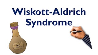 WiskottAldrich Syndrome Mnemonic STEP NCLEX COMLEX [upl. by Maxie]