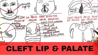 Palatine Bone  Cranial Osteology  Anatomy Lecture for Medical Students  VLearning™ [upl. by Allsun]