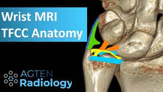 MRI Anatomy of TFCC [upl. by Lisbeth]