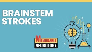 Brainstem Stroke Mnemonics Memorable Neurology Lecture 15 [upl. by Ahsenek]