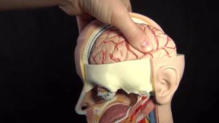 Increased ICP Intracranial Pressure Nursing Care Animation [upl. by Labinnah981]