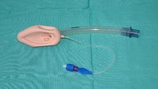 Laryngeal mask airway LMA ATLS [upl. by Aspia272]