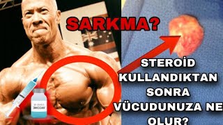 Steroid Kullanınca Vücutta Ne olur [upl. by Leahcimnoj]