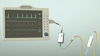 How does the parenchymal ICP measurement from RAUMEDIC work [upl. by Aicire966]