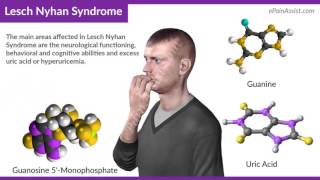 Lesch Nyhan Syndrome [upl. by Bergeron]