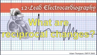 What are reciprocal changes [upl. by Mathe]