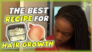 The BEST Onion Juice Recipe for Maximum HAIR GROWTH [upl. by Akimrehs]