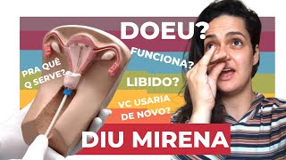 DIU MIRENA  MINHA EXPERIÊNCIA [upl. by Notnef190]