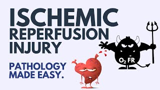 Ischemic Reperfusion Injury Pathology  Explained Simply 2024 [upl. by Roxi]