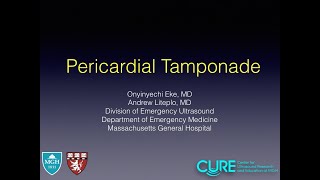 Pericardial Tamponade [upl. by Cathlene504]