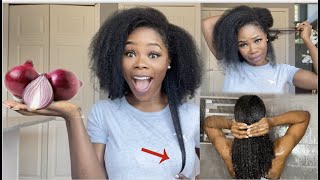 2 WAYS TO USE ONION JUICE FOR MASSIVE HAIR GROWTH  HOW TO USE ONIONS FOR EXTREME HAIR GROWTH [upl. by Baylor994]