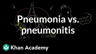 Pneumonia vs pneumonitis  Respiratory system diseases  NCLEXRN  Khan Academy [upl. by Icat]