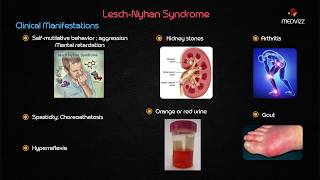 LeschNyhan syndrome  Usmle step 1 Biochemistry Case Based discussion [upl. by Krenek871]