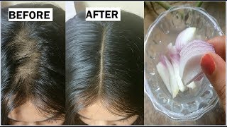 Onion amp Coconut oil for Extreme HAIR GROWTH in 30 Days to get long hair thick hair naturally [upl. by Anaeda539]