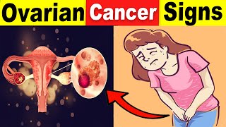 9 Common Ovarian Cancer Signs That You Should Never Ignore [upl. by Ybrad965]