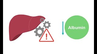 Getting to know albumin physiology [upl. by Enihpled43]