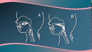 Chapter 3  Understanding Cleft LipPalate Physiology [upl. by Ahsiuq882]